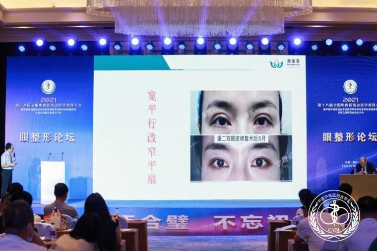 潘贰博士,潘贰博士双眼皮修复技术真的好吗