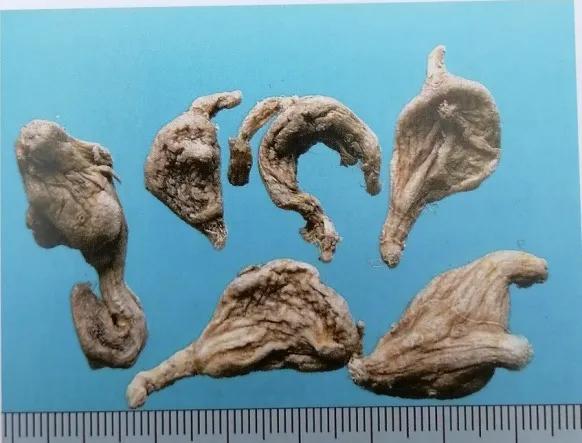 止血收敛的药有哪些,收敛止血中成药有哪些