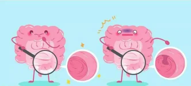 便血不止，大娘当“痔疮”越治越严重！肠镜王子“内镜绝技”巧除肠内巨大肿瘤