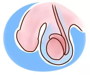 今天来讲讲男宝蛋蛋可能遭遇的那些事