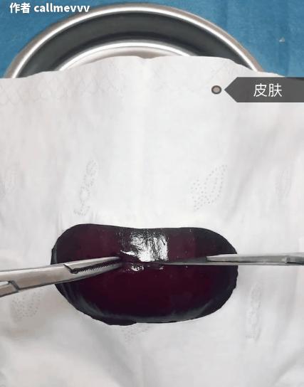 香蕉割包皮,洋葱剖腹产?这是我见过最秀的医生