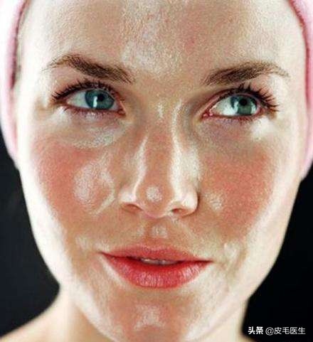 皮肤容易出油的小妙招,油性皮肤怎么补水控油