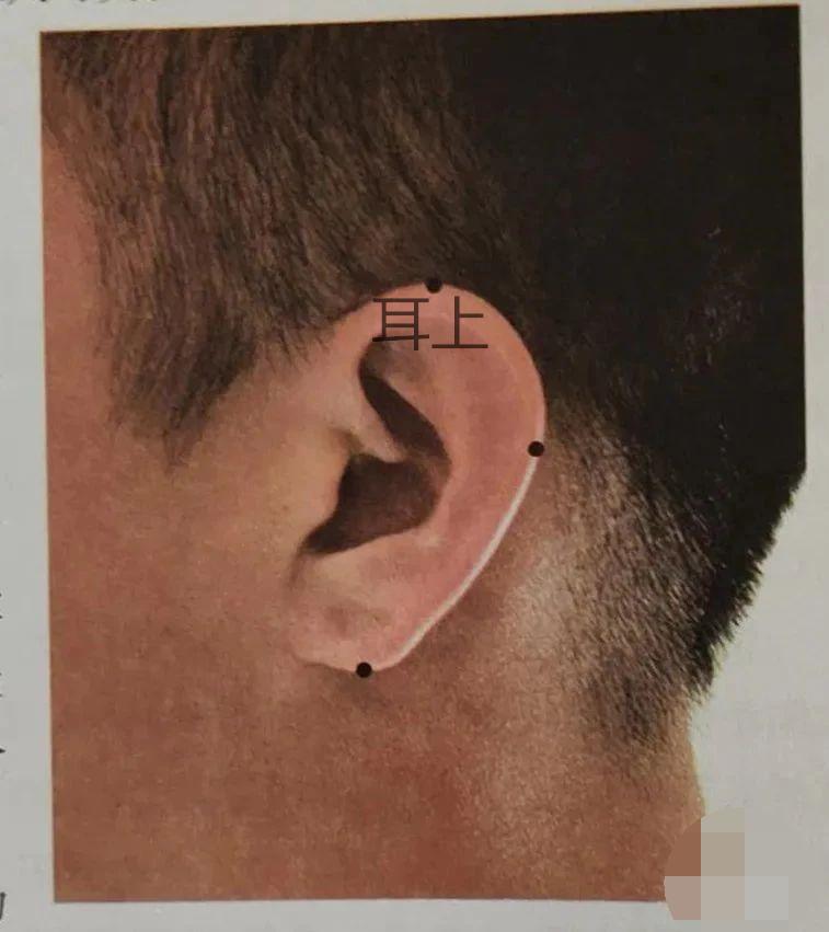 耳朵经常嗡嗡响可以中医针灸吗,耳朵乳突炎能针灸治疗治愈吗