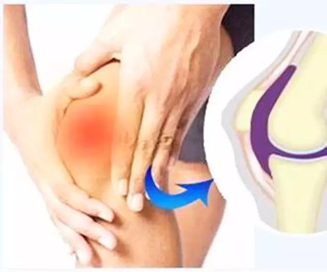 受冷引起的膝盖滑膜炎能自愈吗,膝盖冰凉滑膜炎怎么确诊