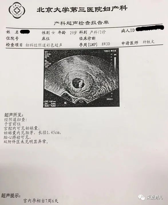 7周未见卵黄囊未见胎芽胎心,未见胎心胎芽搏动是什么意思