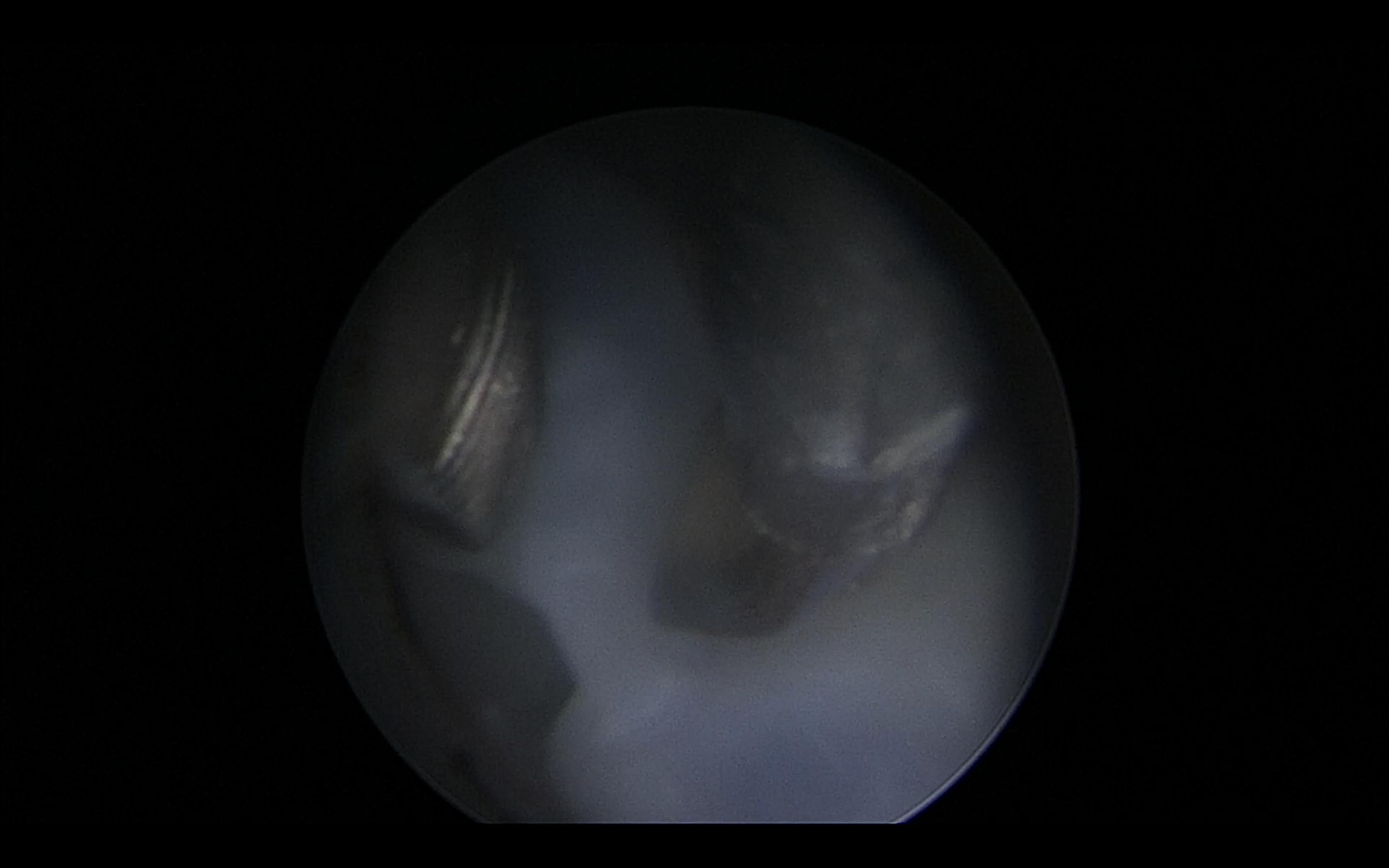 双胞胎大小相差一周怎么调养,双胞胎b超显示一大一小怎么办