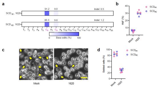 新一代单碱基编辑技术有望治愈β-地中海贫血和镰刀状贫血症