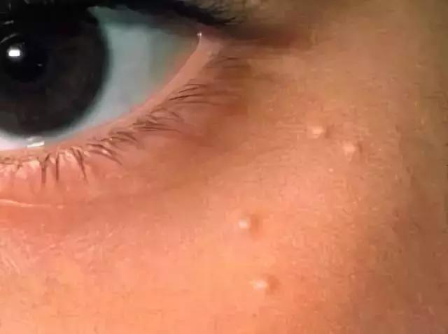 拥有这几种眼霜，你就是这条gai上最靓的仔