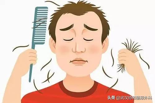 植发的十大潜规则,植发快问快答