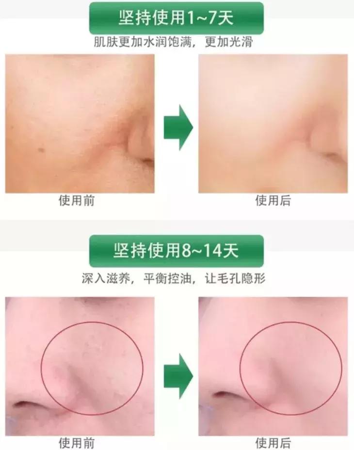 李佳琦推荐的这款日本蜜梨面霜，几分钟卖2万瓶？