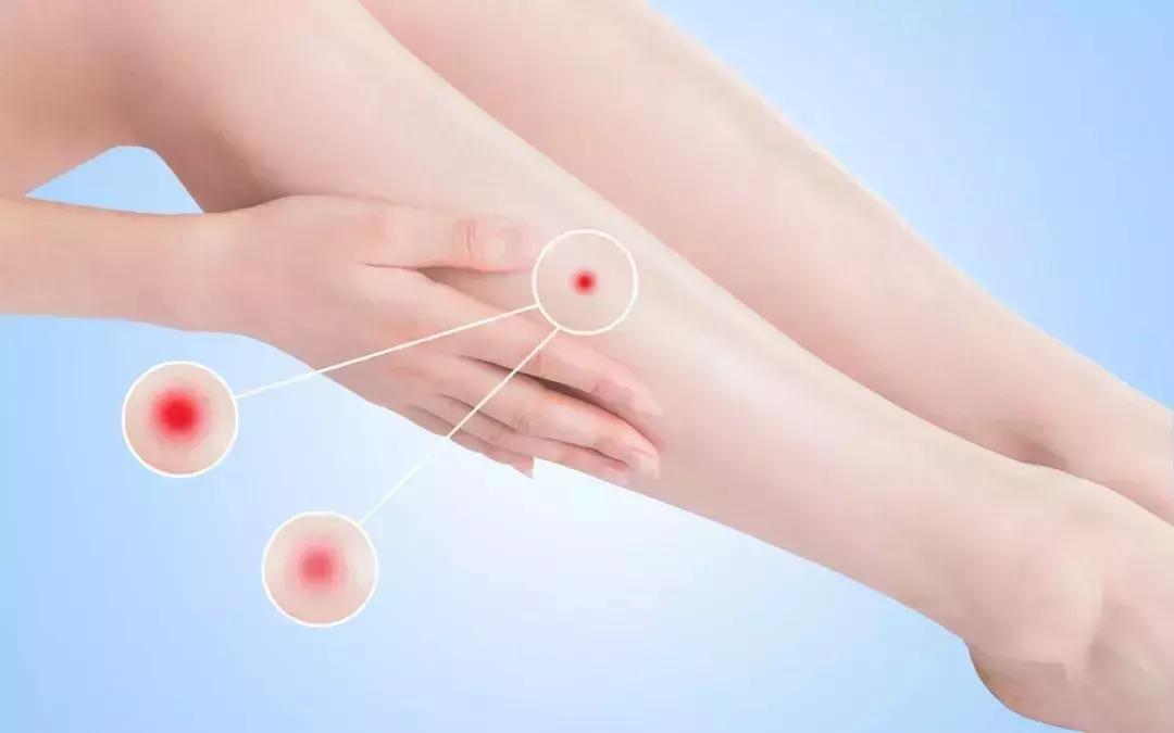 梅雨季这些事要注意!一不小心就轮到你了