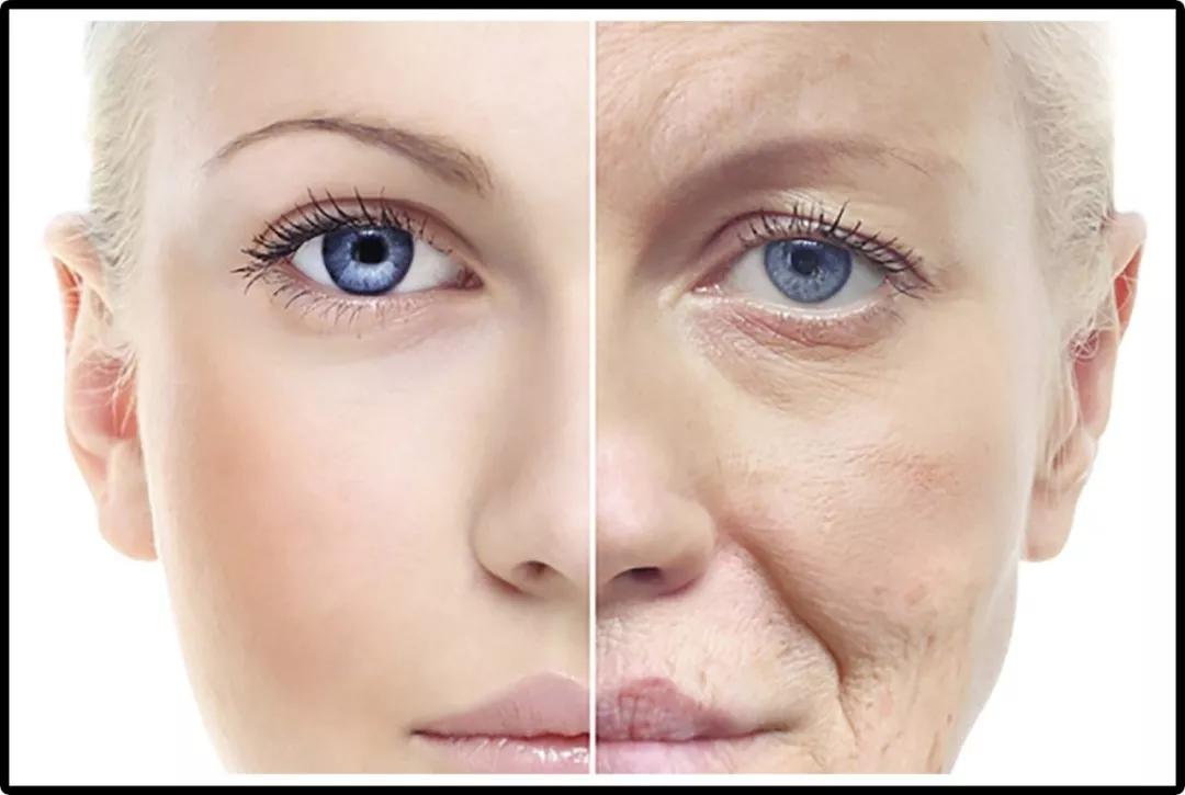 最有效的法令纹贴,如果你有眼袋法令纹