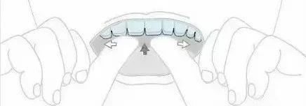 嫌隐形牙套难摘戴?那是你的姿势不正确