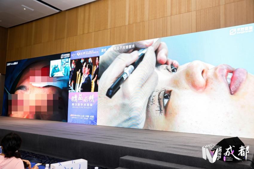 潘贰博士受邀到2021年成都美沃斯大会上作手术教学示范并分享心得