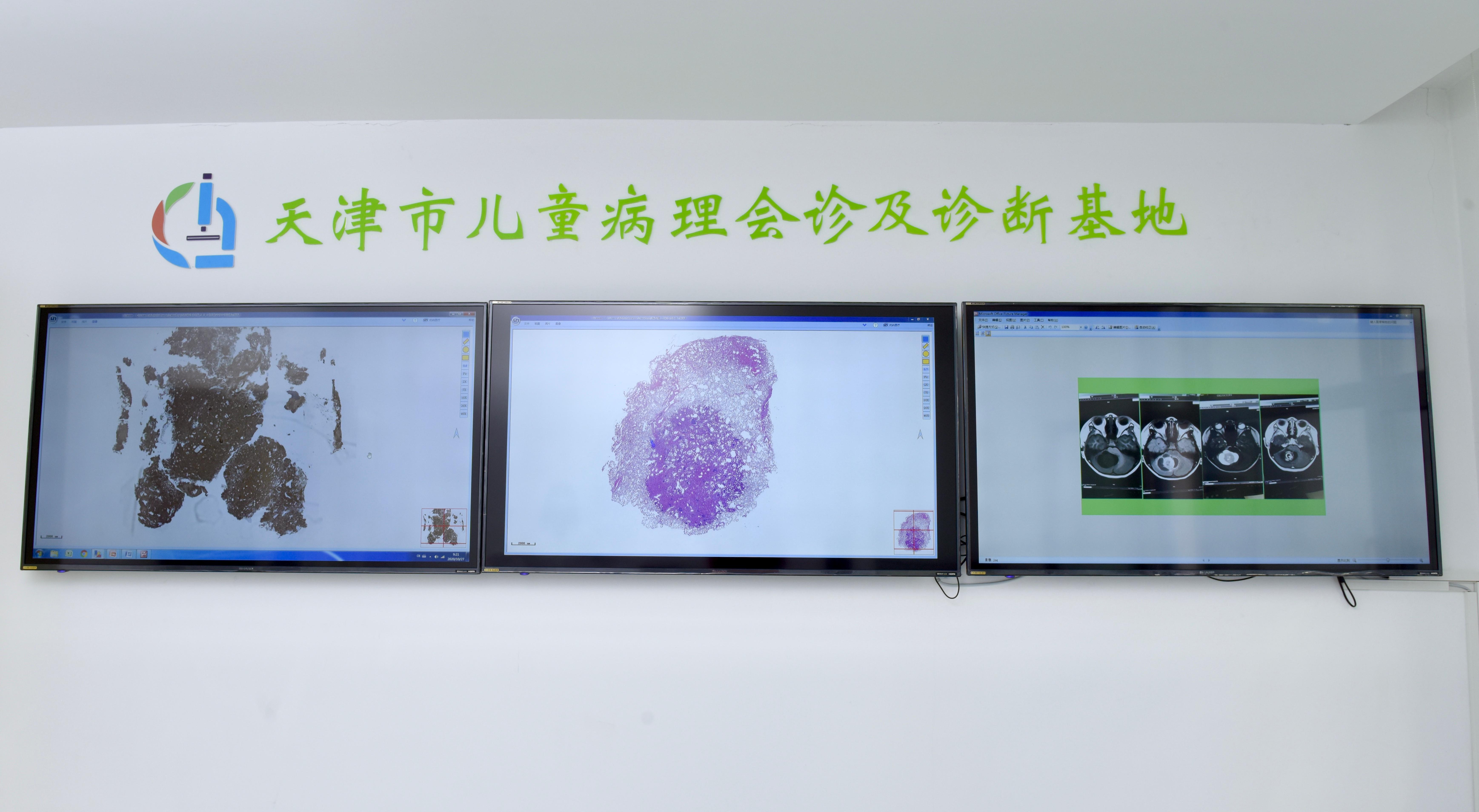 天津儿童医院院长刘薇微博,天津市儿童医院刘薇