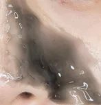 公认最好用的去黑头神器,网红推荐去黑头神器