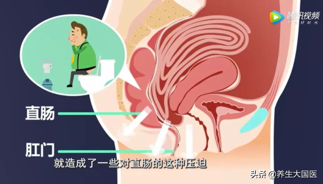 腹易胀便秘,便秘引起腹痛