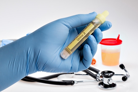 痛风慢性期怎么治愈,痛风慢性期可用哪种药物维持治疗