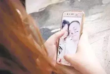 男子被一条狗疯咬,男子被狗追咬全身缝300多针