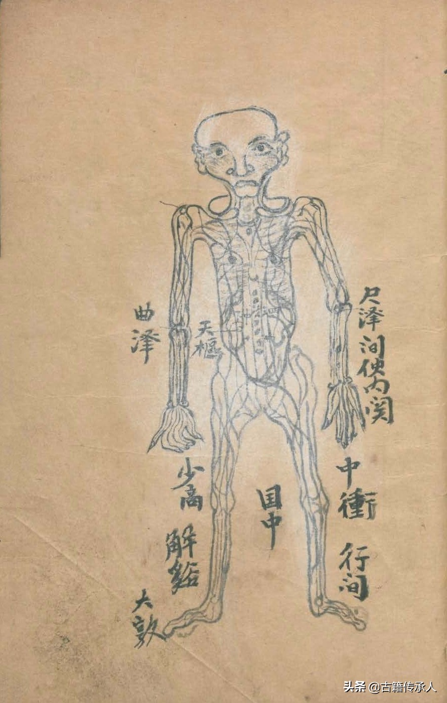 中医针刺放血疗法书,中医古籍阴阳针