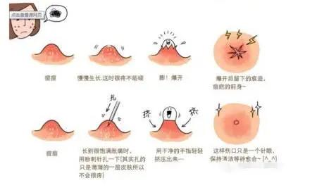 脸上长各类痘痘的原因和解决方法,脸上长粉刺痘痘的原因和解决方法