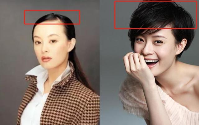 拯救秃头少女的新思路纹发,拯救脱发少女的办法