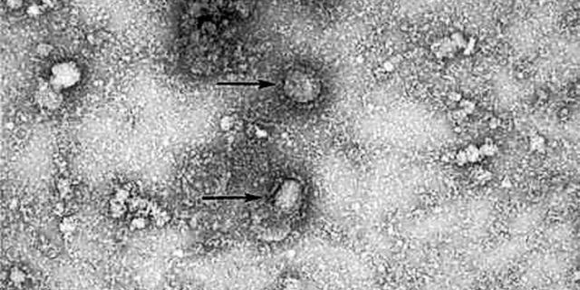 新型冠状病毒pcr检测操作规程,冠状病毒核酸检测pcr试剂