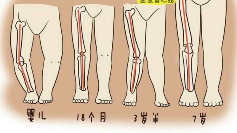 鞋子高帮和低帮影响孩子足踝发育吗?孩子八字脚怎样矫正?