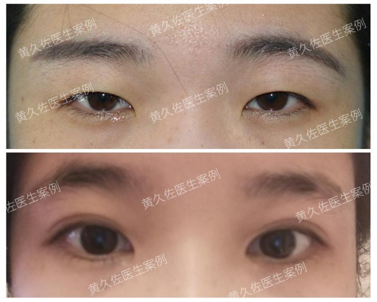 总觉得双眼无神,被说双眼无神