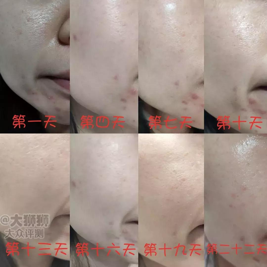 澳洲药房抗衰护肤品,澳洲药房护肤品抗皱补水