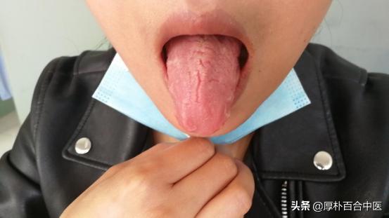 胃脘胀痛反酸烧心,胃脘痛烧心两肋痛怎么回事