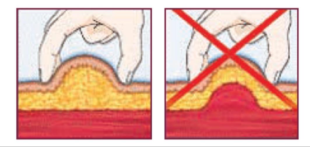 鐙楃嫍鐤嫍姝ｇ‘娉ㄥ皠鏂规硶,鐙楃嫍娉ㄥ皠鐤嫍瑙嗛鏁欑▼
