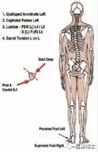 正美体态矫正脊柱侧弯真的有用吗,先天脊柱侧弯体态矫正有用吗