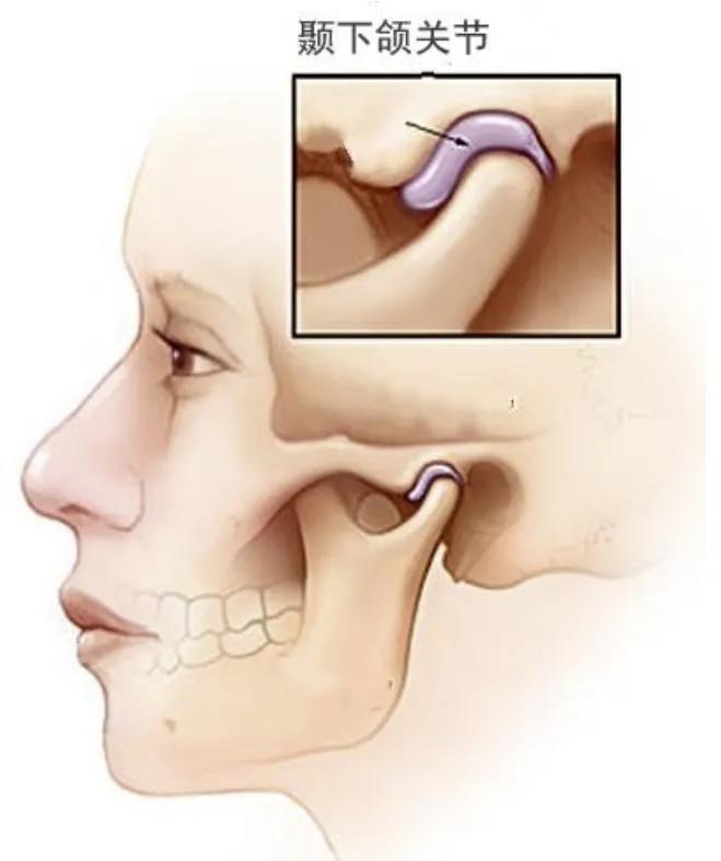 张嘴有咯噔的声音怎么解决,张嘴响声怎么治疗