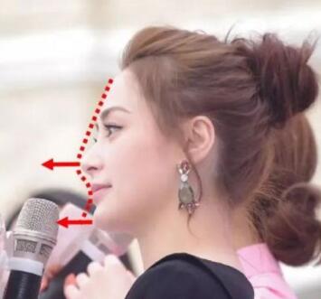 面部一枝花全靠鼻当家,论鼻子对颜值的重要性▼