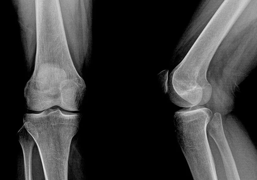 全身关节都有毛病怎么治,膝关节为什么会发炎