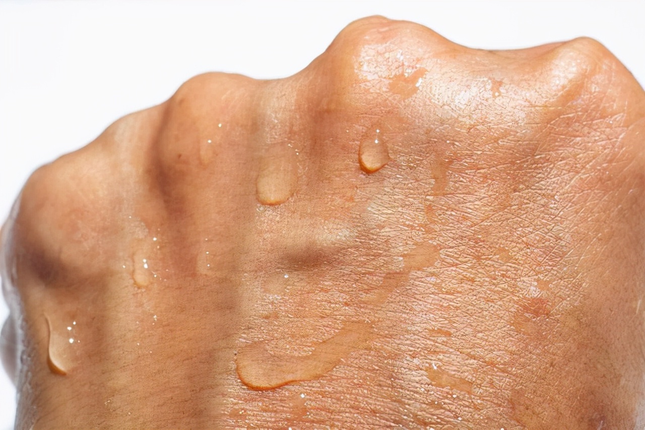 浓硫酸溅到眼睛上正确的处理方法,被浓硫酸溅到多久能好