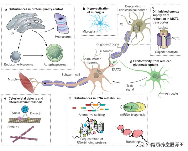 人体健康之运动神经元病,运动神经元病的锻炼方法