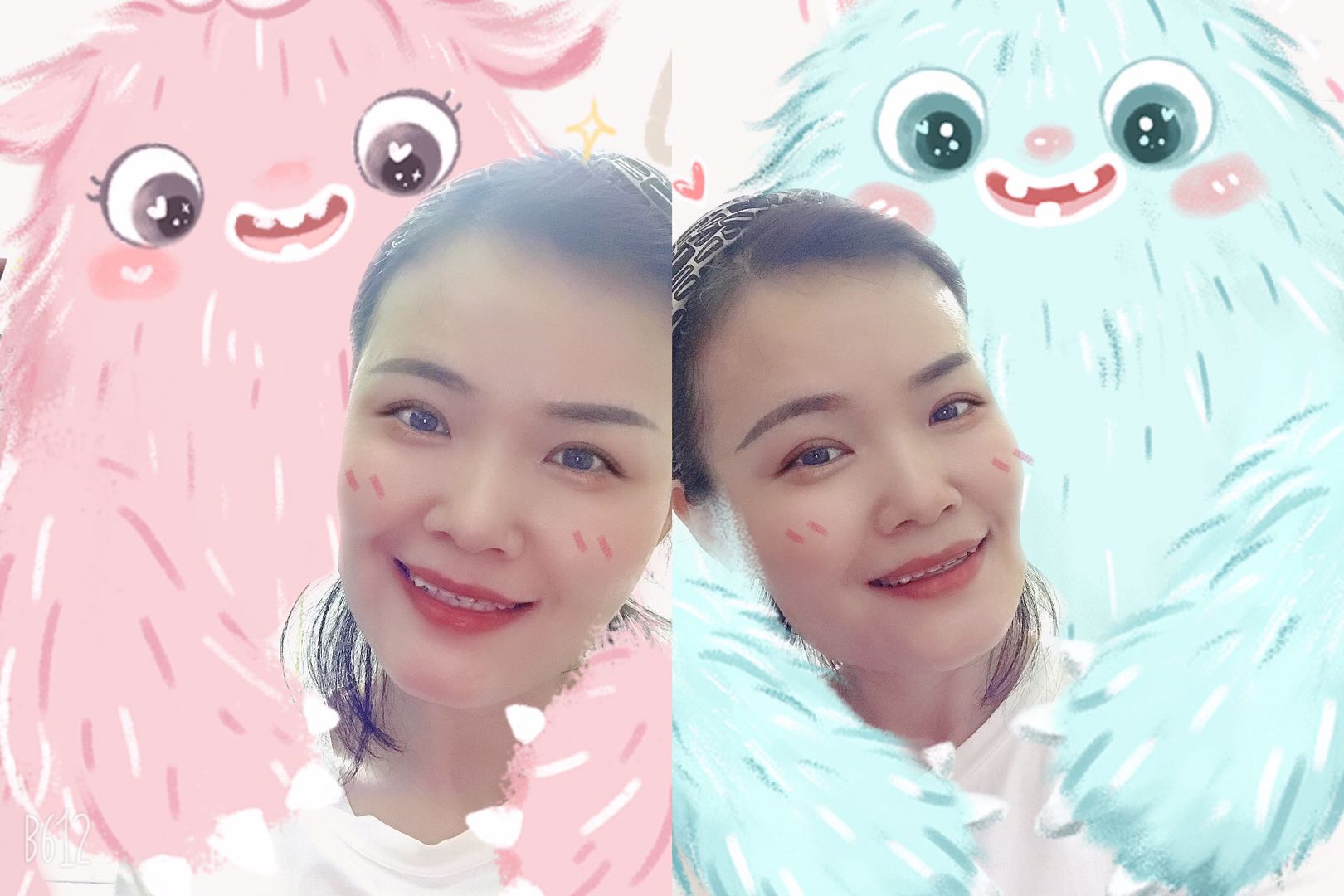 男的割双眼皮好看吗,割双眼皮好看吗动画