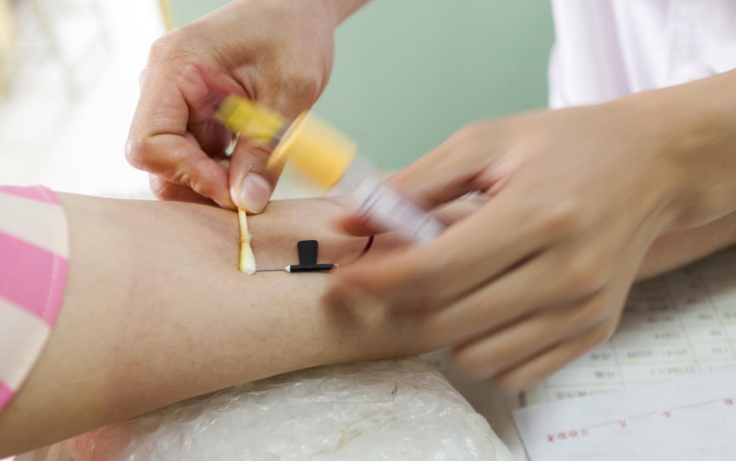 最稀有的孕妇血型,孕妇稀有亚型血型