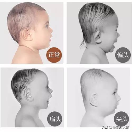 新生宝宝的一些正常现象,天使宝宝的症状有哪些