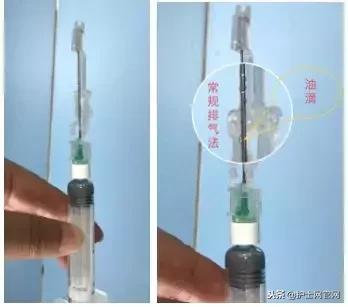 皮下注射没排气会怎样,皮下注射不捏皮肤可以吗