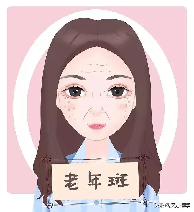 做斑一年了皮肤有点红,做斑后会变得很老吗