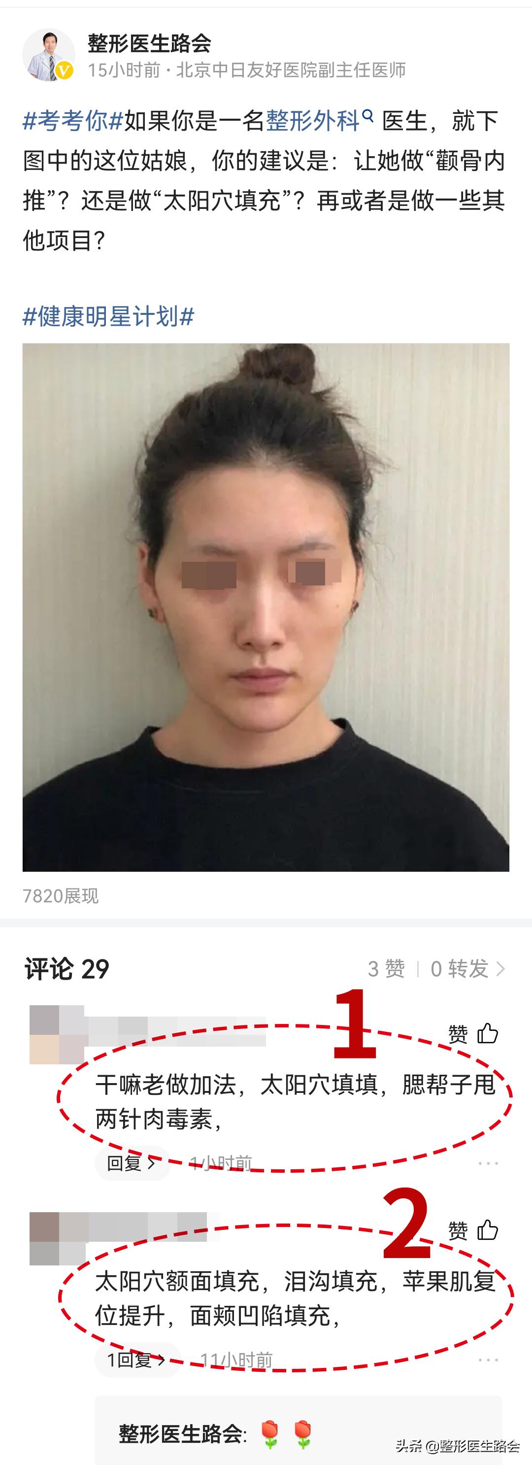 太阳穴凹陷颧骨高适合留中分吗,太阳穴凹颧骨高用什么哑光高光好