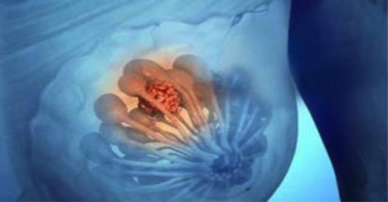 花钱推拿真的有用吗,花钱隆胸值不值得