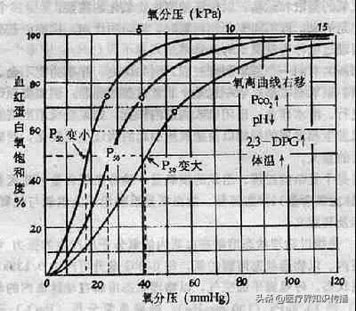 动脉血气分析6步轻松搞定,动脉血气分析常用部位图解