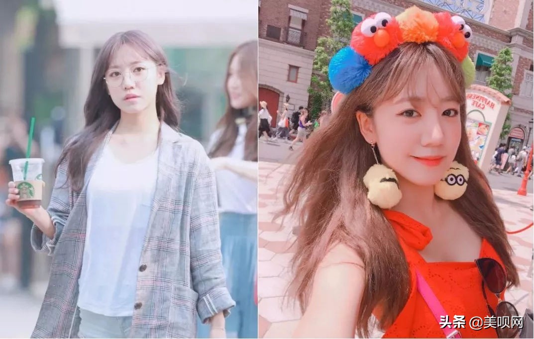 明星都在用的缩小鼻翼神器,明星鼻子做鼻翼缩小外切