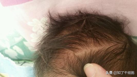 给孩子剃胎毛的小妙招,剃胎毛对宝宝有哪些好处