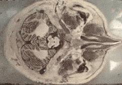 生物实验使用显微镜怎么用双眼看,生物显微镜人眼看到的图像