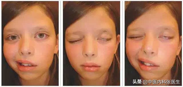 八珍汤加桂枝汤医案,千金妙方八珍汤